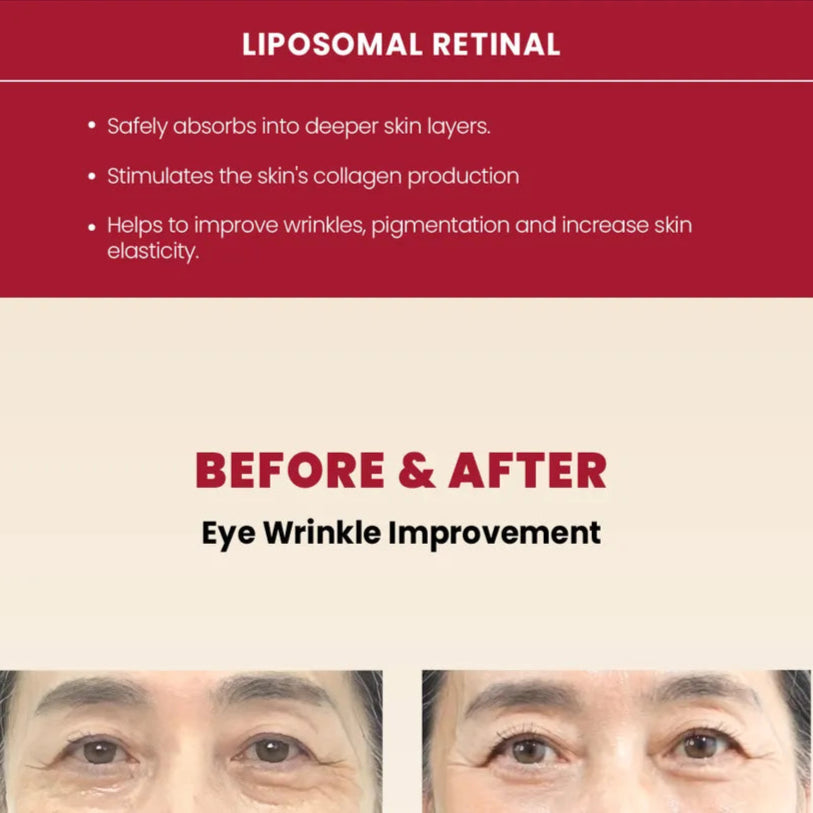 SEOUL 1988 Eye Cream Retinal Liposome 4%